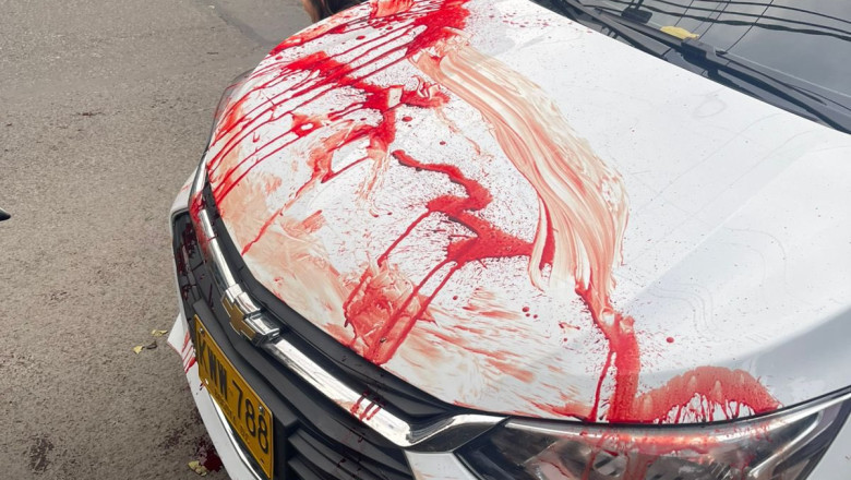 Kolumbia senaatorit Miguel Uribe-t tulistati pähe