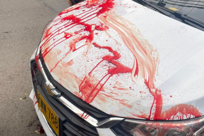 Kolumbia senaatorit Miguel Uribe-t tulistati pähe