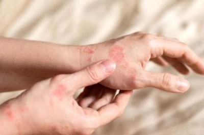 Patendirikkumine: Monsanto/Bayer kaebab Covidi 